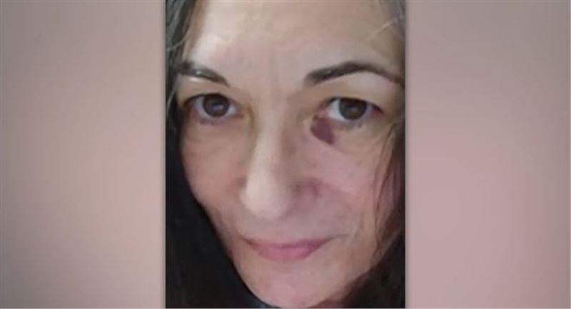 Epstein´in suç ortağı Maxwell´in fotoğrafı yayınlandı: Sol gözünde morluk var