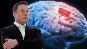 Elon Musk, insan beynine çip takacak
